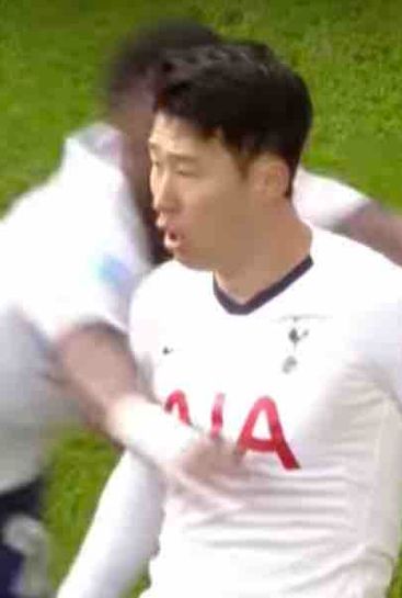Heung-min Son set for surgery on fractured arm