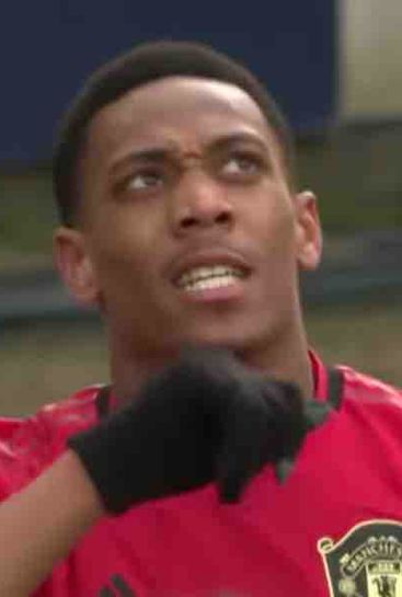 Anthony Martial to undergo scan ahead of Everton game