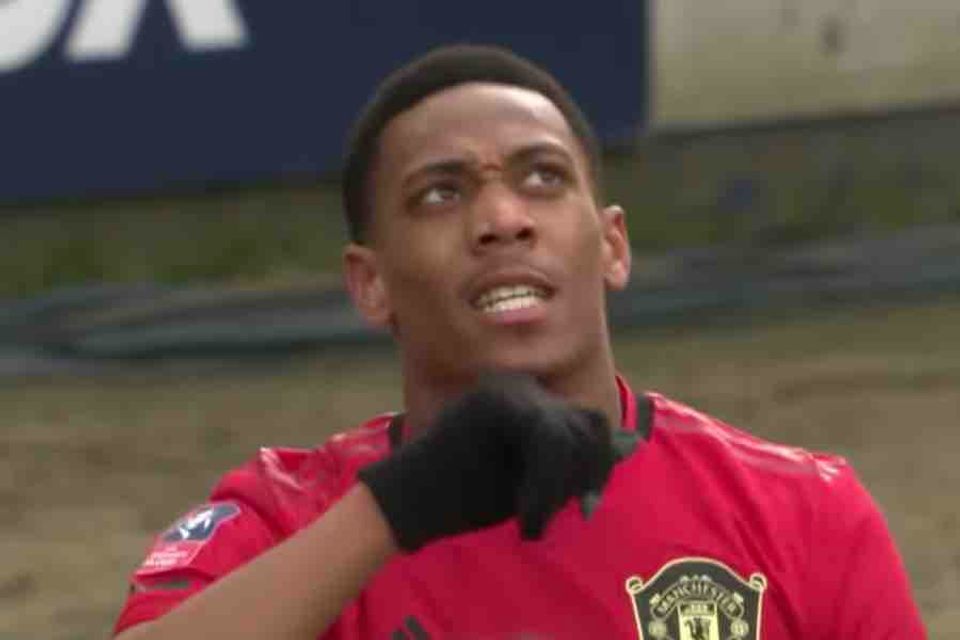 Anthony Martial to undergo scan ahead of Everton game